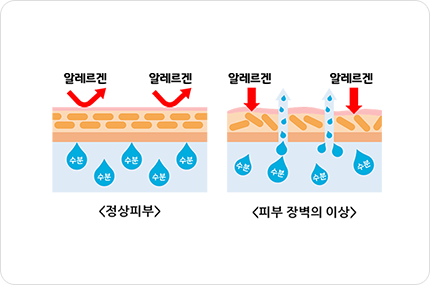 정상피부와 피부 장벽의 이상 비교 이미지