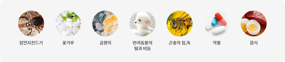 알레르겐이란?